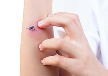 Why Do Mosquito Bites Itch?